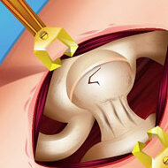 Игра Операция Барби