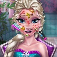 Игра Лечение кожи Эльзы