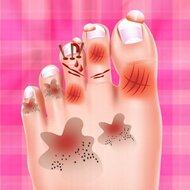 Игра Лечение ноги